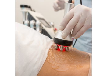 Radijo dažnis kosmetologijoje: kokios jo rūšys, kuo skiriasi ir kurią rinktis?