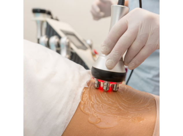 Radijo dažnis kosmetologijoje: kokios jo rūšys, kuo skiriasi ir kurią rinktis?